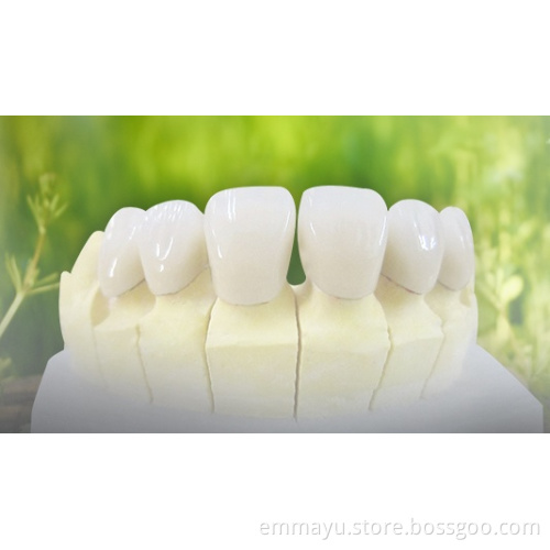 Porcelain teeth